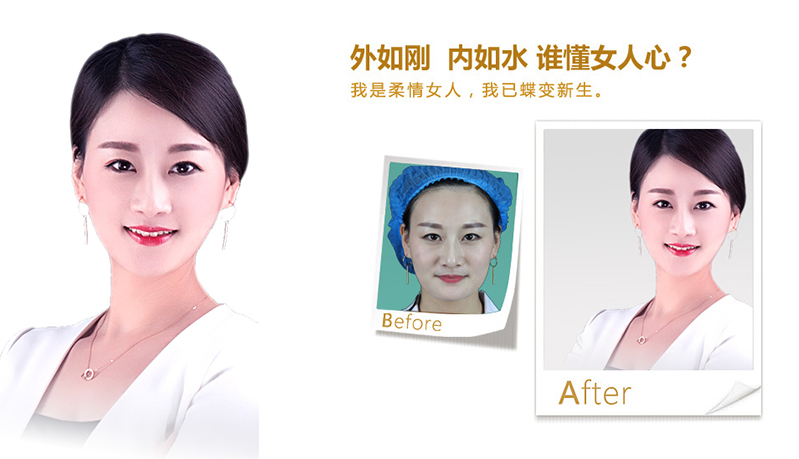 福州V脸、线雕隆鼻